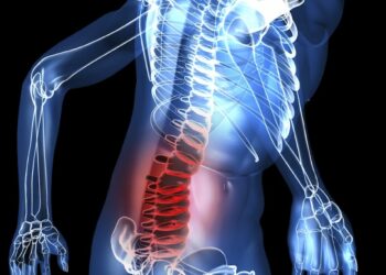 Radiografía de columna vertebral, identificando un trastorno musculoesquelético tratable con el Método Ovando Sanders