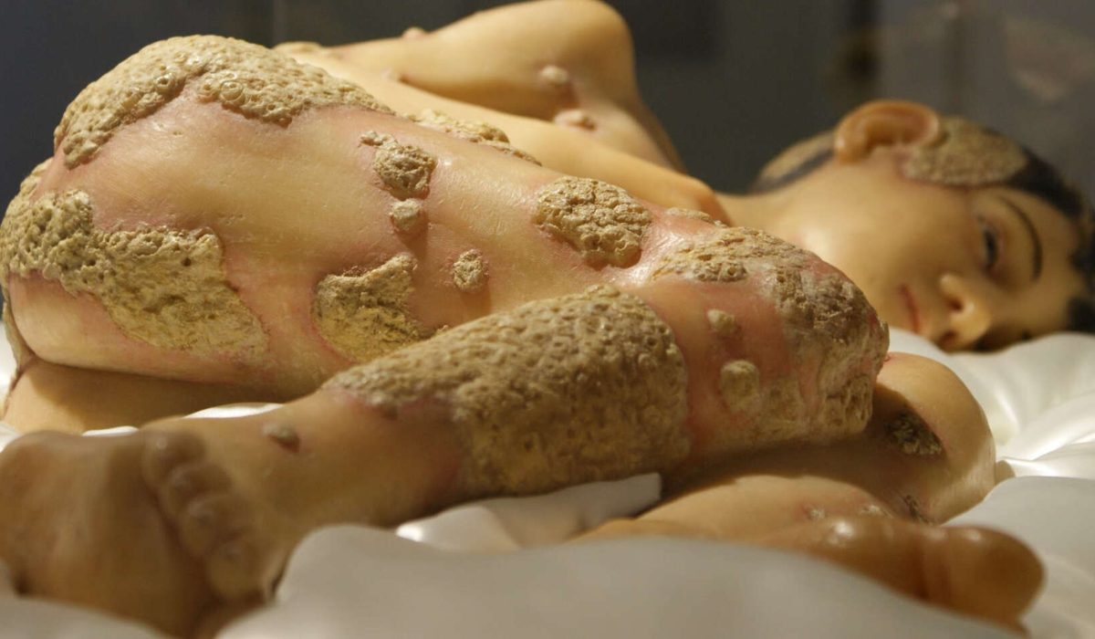 El Museo Olavide cierra sus puertas: la joya médica se queda sin hogar