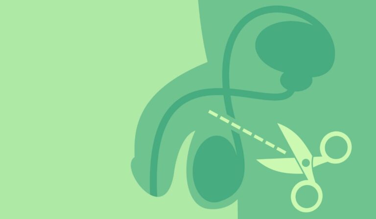 Cada vez más jóvenes optan por la vasectomía: el alto costo de vida influye en la decisión